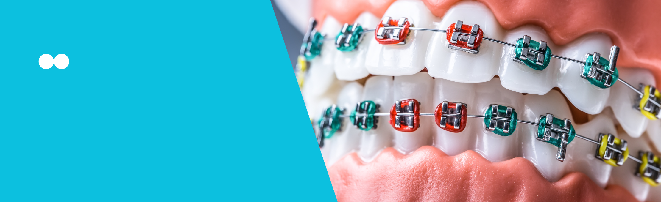 Kieferorthopädische Produkte